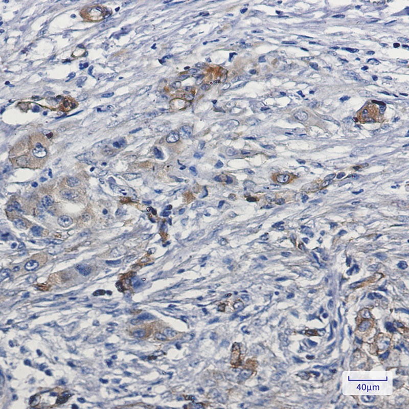 MYO1B Antibody