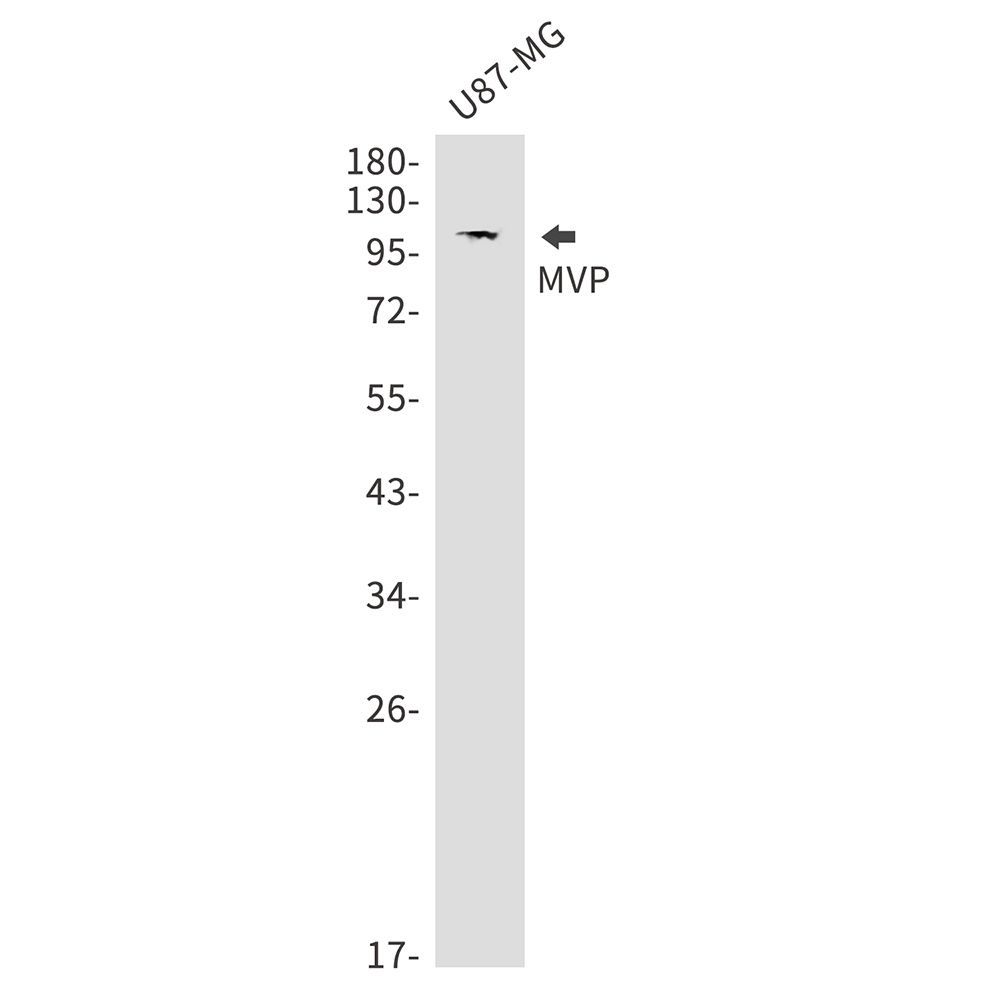MVP Rabbit Monoclonal Antibody