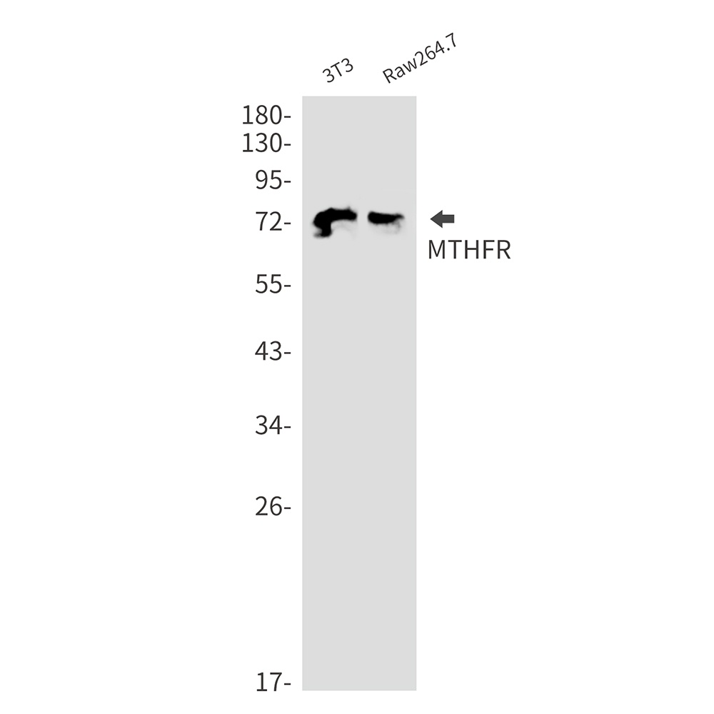 MTHFR Antibody
