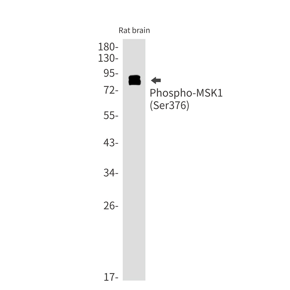 RPS6KA5 Antibody