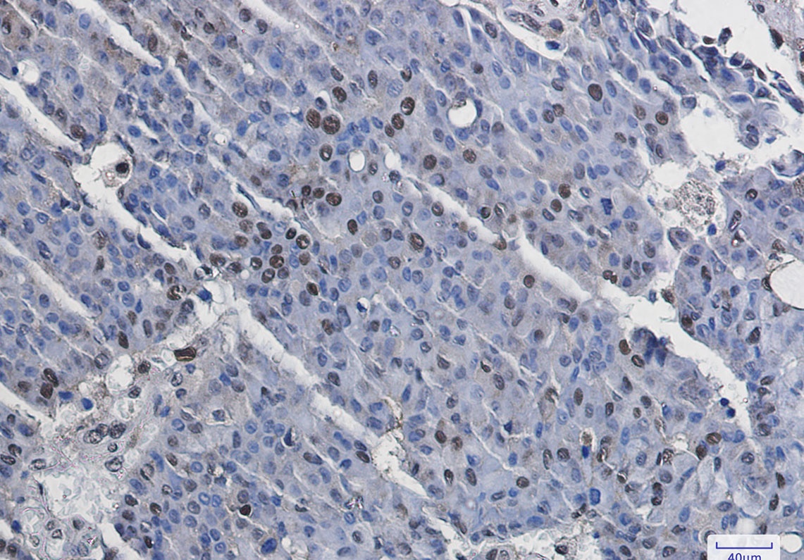 RPS6KA5 Antibody