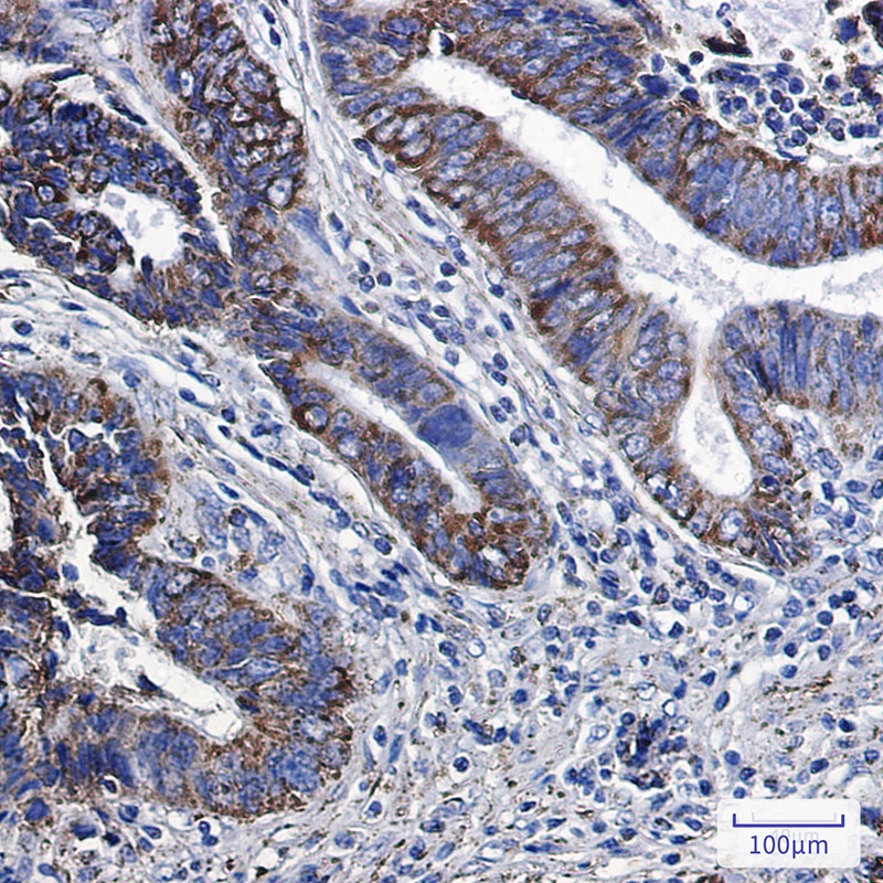 MGST3 Rabbit mAb