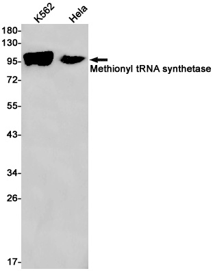 MetRS Rabbit mAb