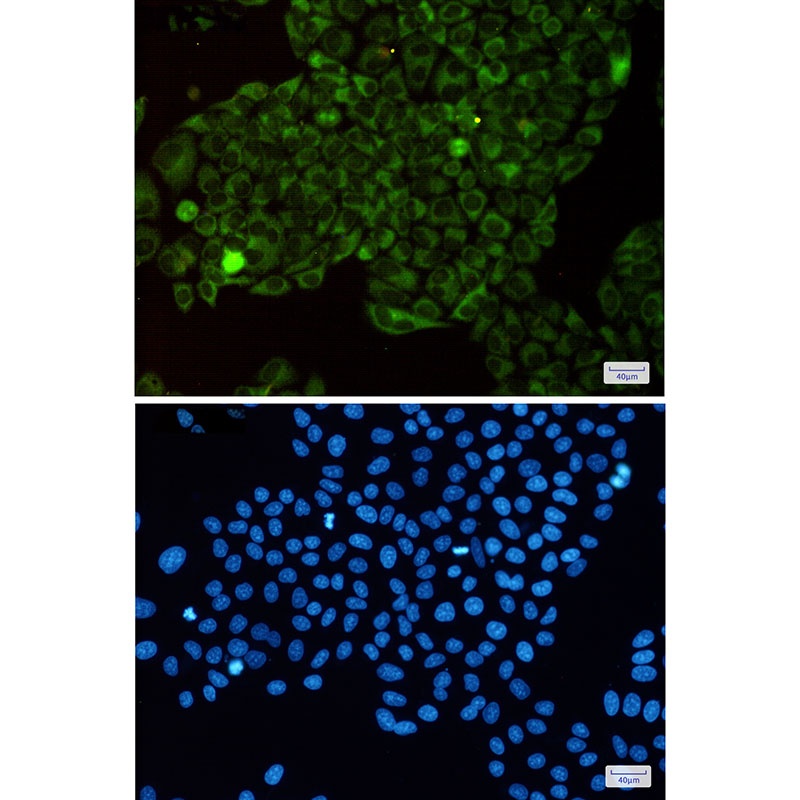 MetRS Rabbit mAb