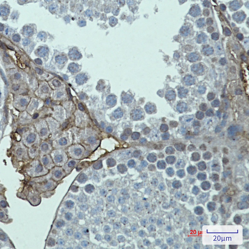Metabotropic Glutamate Receptor 2 Rabbit mAb