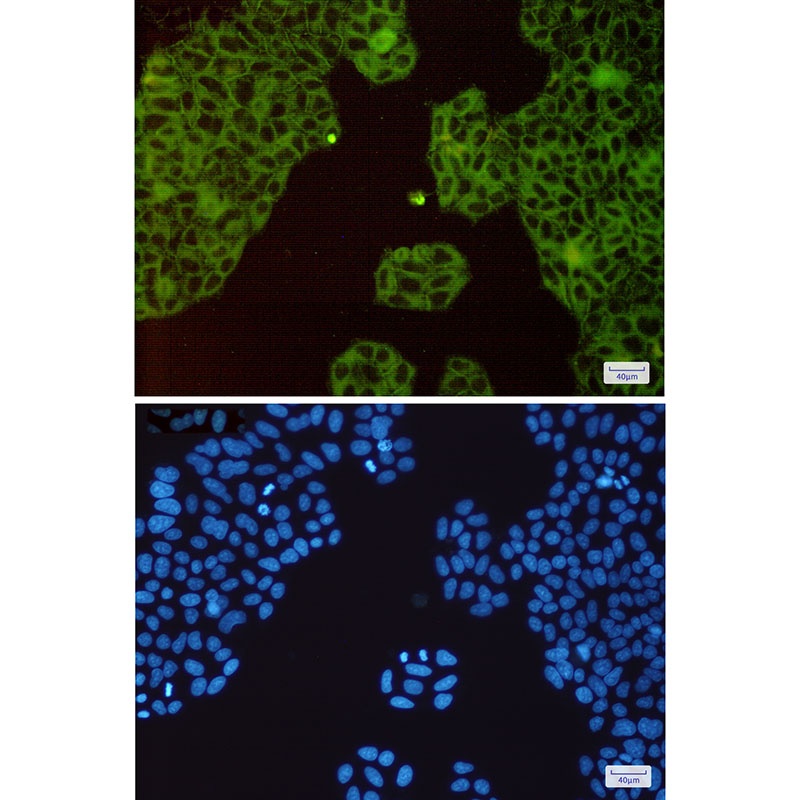 MET Antibody