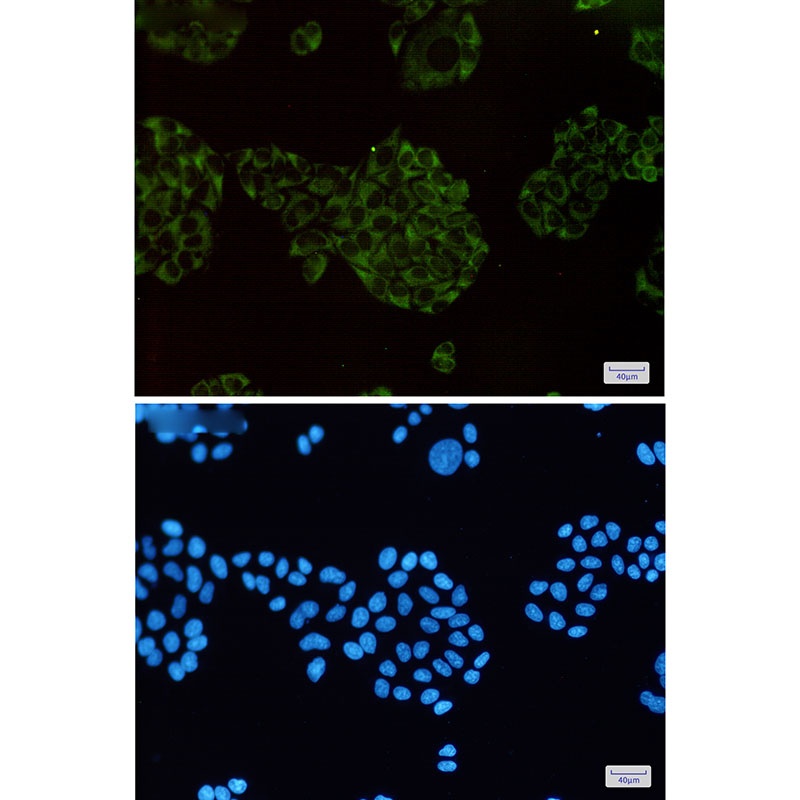 MAP3K2 Antibody