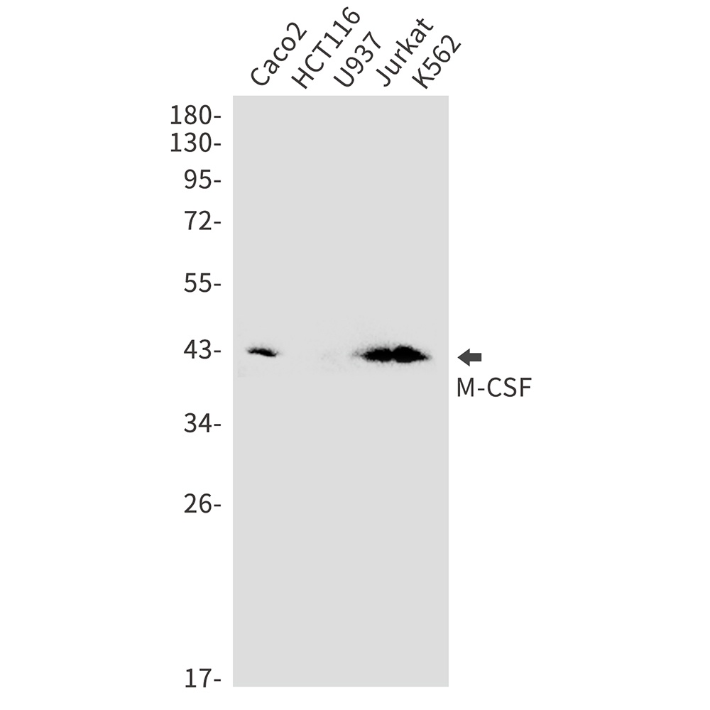 M-CSF Rabbit Monoclonal Antibody