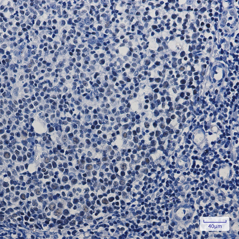 [KD] MBD2 Rabbit mAb