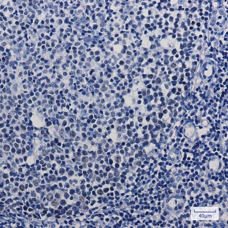 MBD2 Antibody