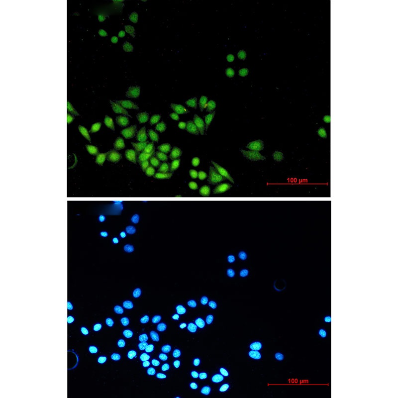 [KO] MAD2L2 Rabbit mAb