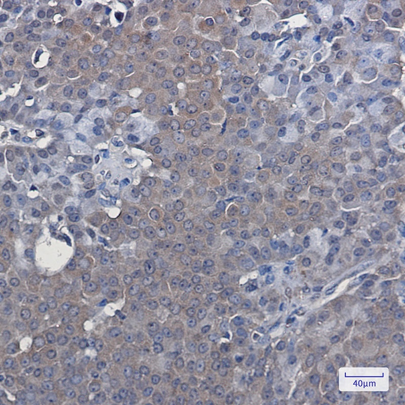 LXR alpha Rabbit Monoclonal Antibody