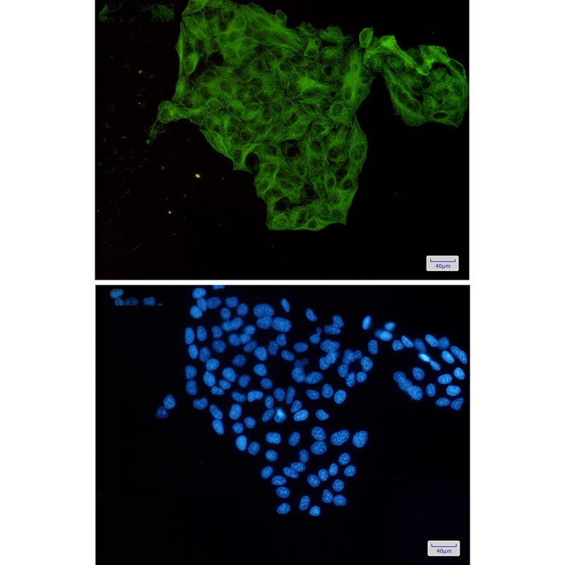 Lumican Rabbit mAb