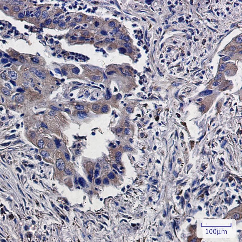 Lumican Rabbit mAb