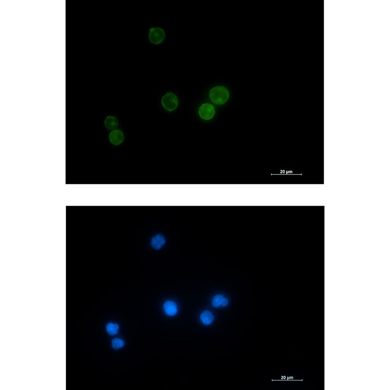 LCK Antibody