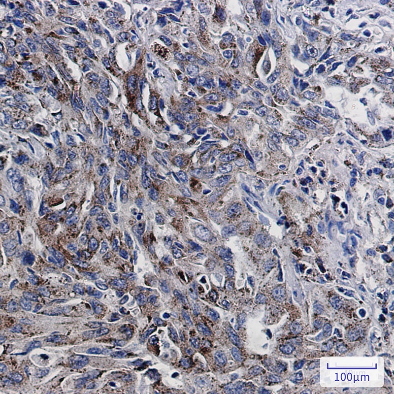 LAMP2 Rabbit mAb