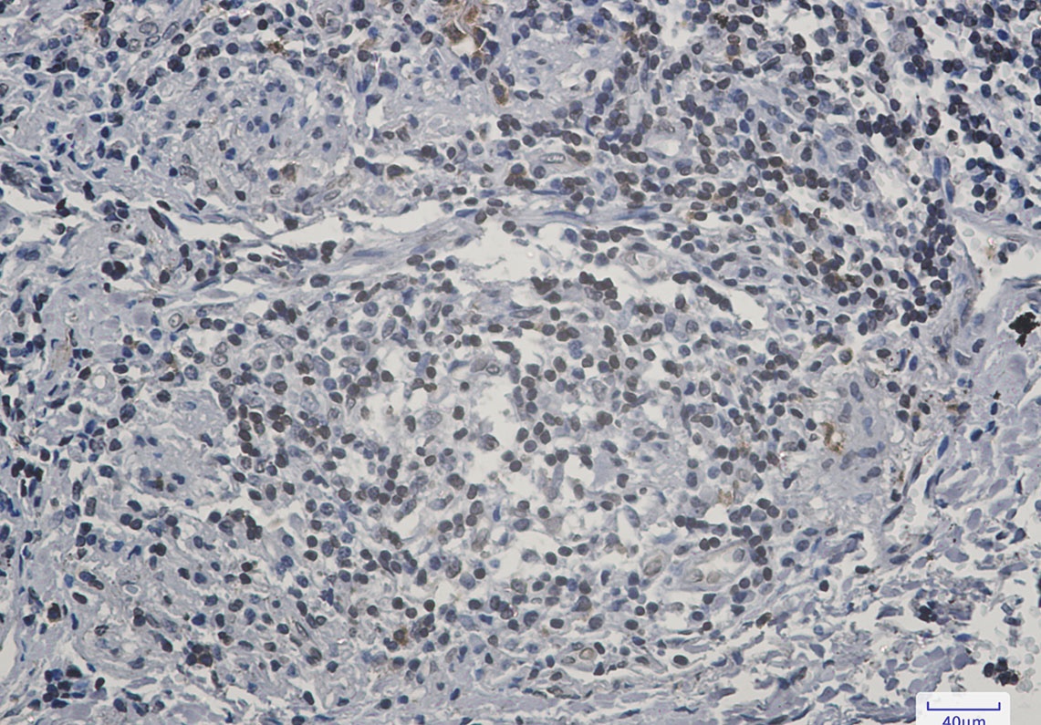 LBR Antibody