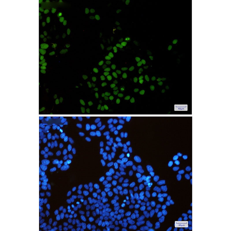 KIFC1 Rabbit mAb