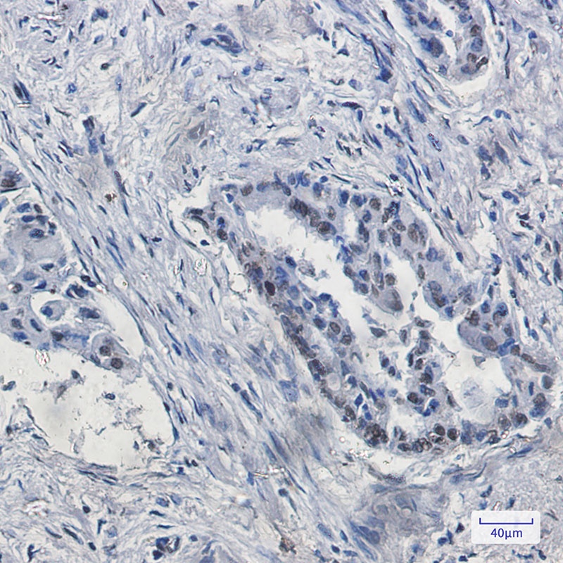 KDM4B Rabbit mAb