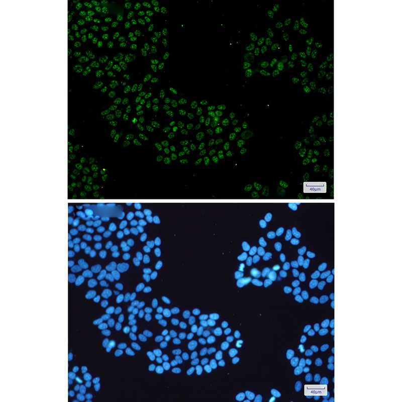 KDM4B Rabbit mAb