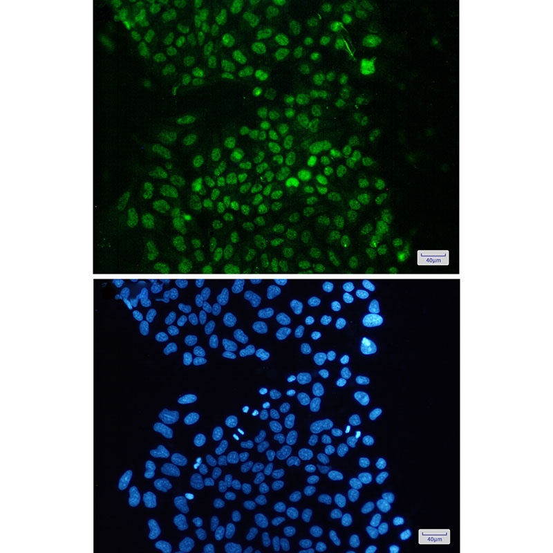 KDM1A Antibody