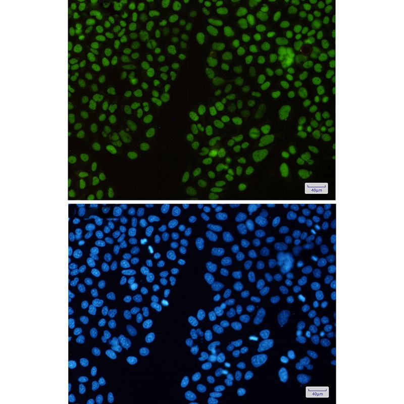 HAT1 Antibody