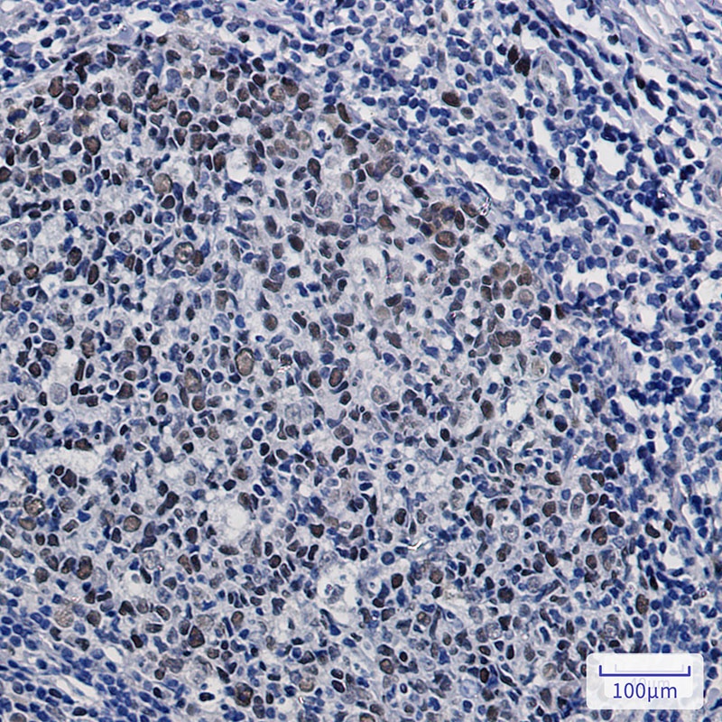 HAT1 Antibody