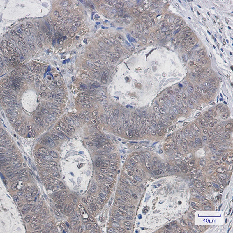 UBB Antibody