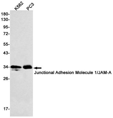 Junctional Adhesion Molecule 1 Rabbit mAb