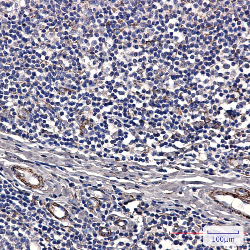 IRAK4 Rabbit mAb