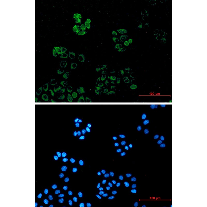 IRAK4 Rabbit mAb
