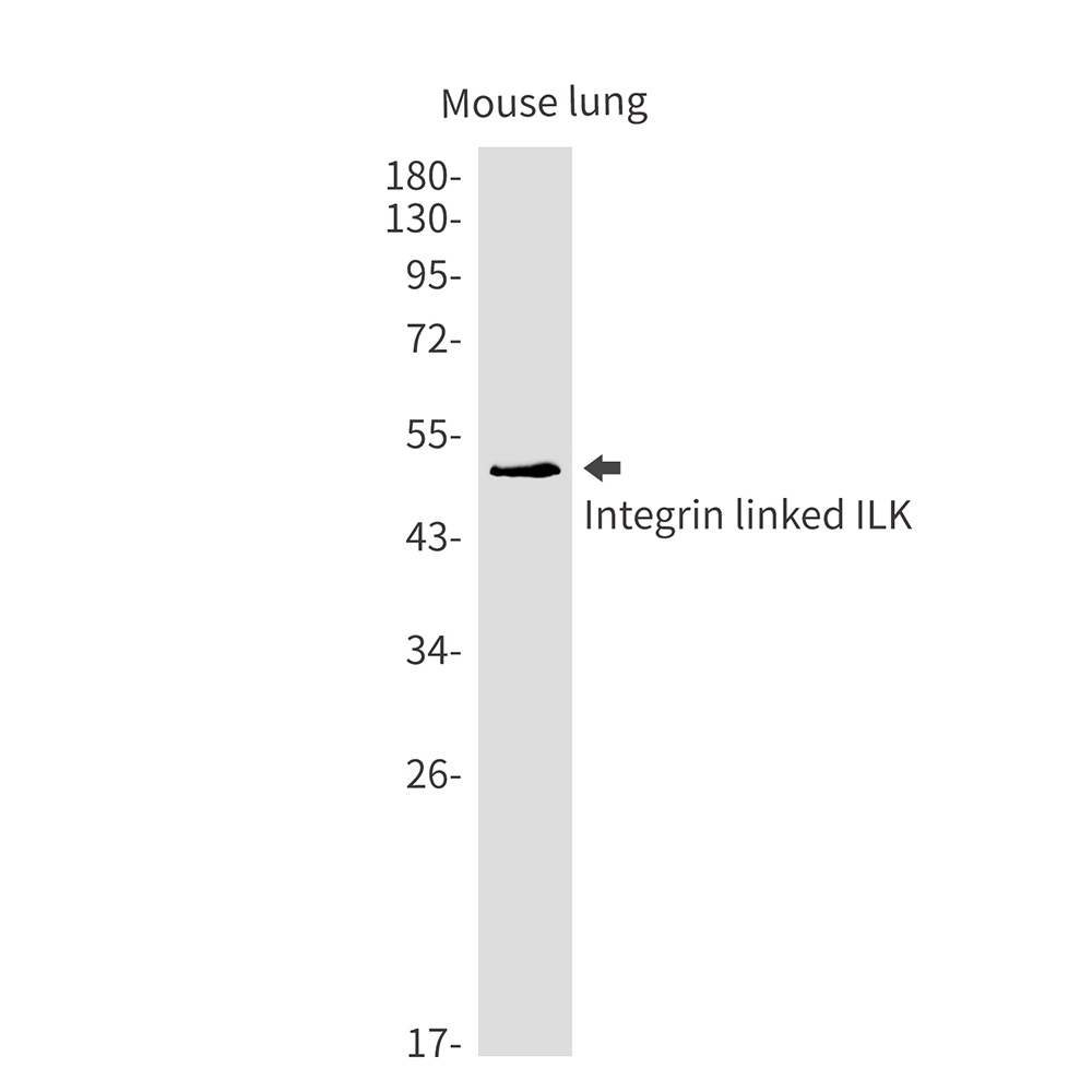 Integrin Linked ILK Rabbit mAb