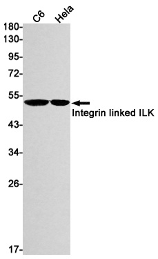Integrin Linked ILK Rabbit mAb