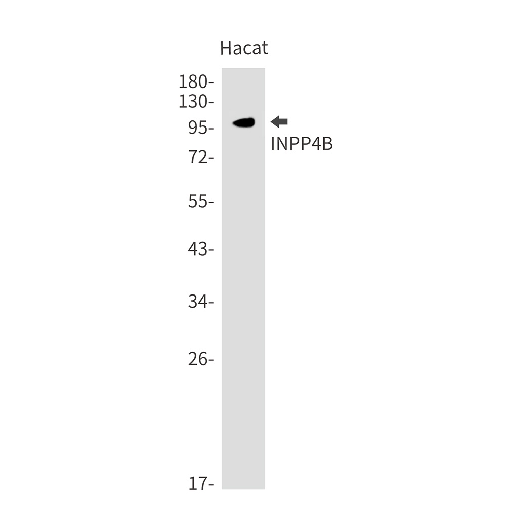 INPP4B Antibody