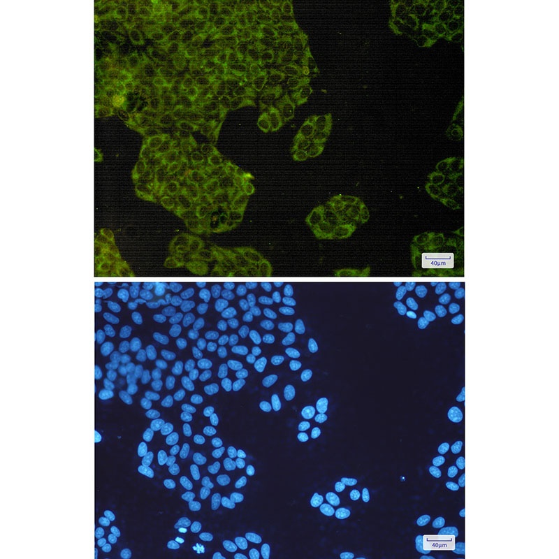 IMP3 Rabbit mAb