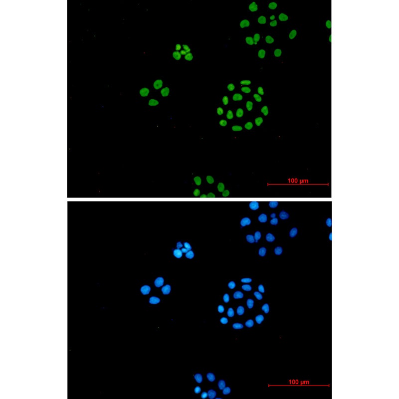 ILF3 Rabbit mAb