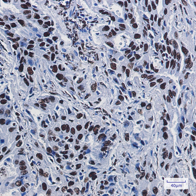 ILF3 Rabbit mAb
