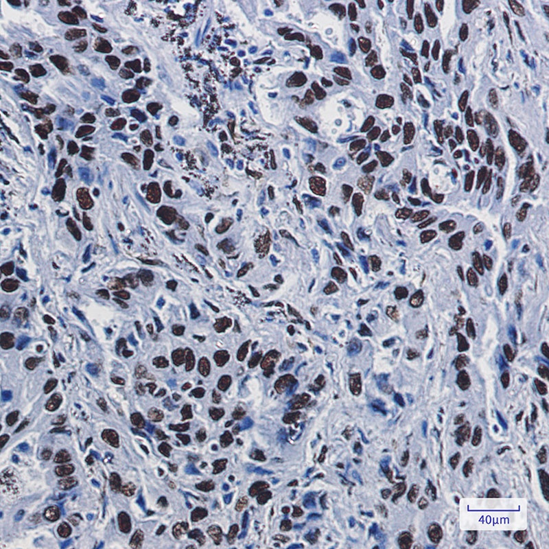 ILF3 Antibody