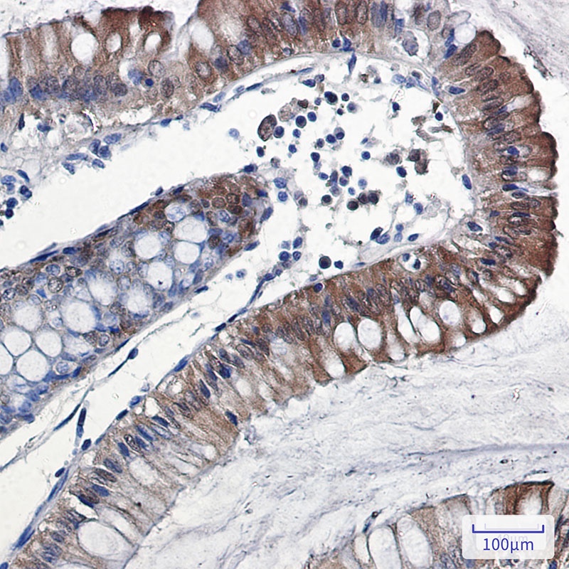 IL-18 Rabbit Monoclonal Antibody