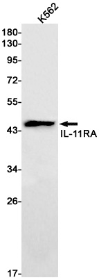 IL-11 Receptor alpha Rabbit mAb