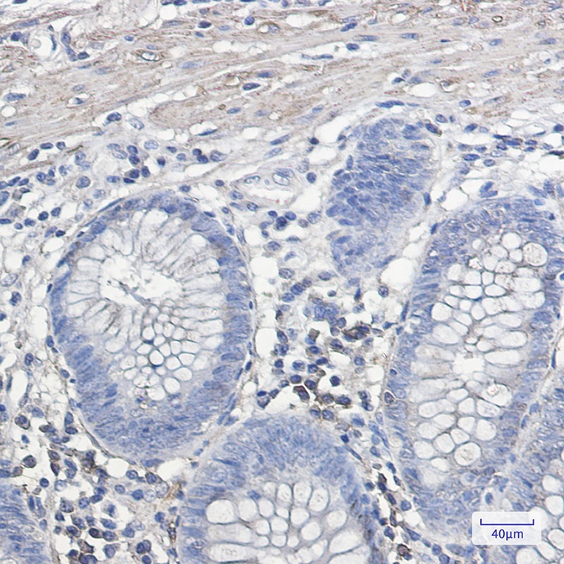 IL-11 Receptor alpha Rabbit mAb