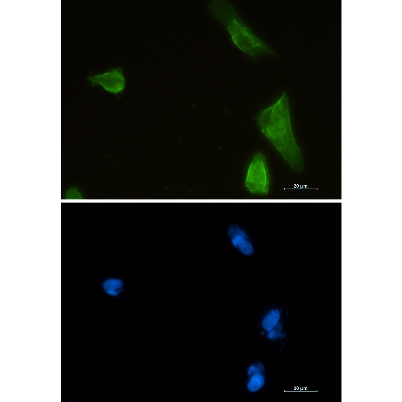 IKBKB Antibody
