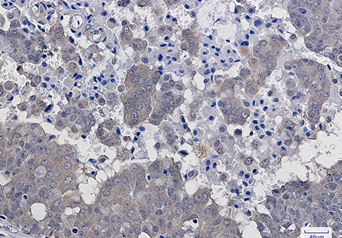 IKB beta Rabbit mAb