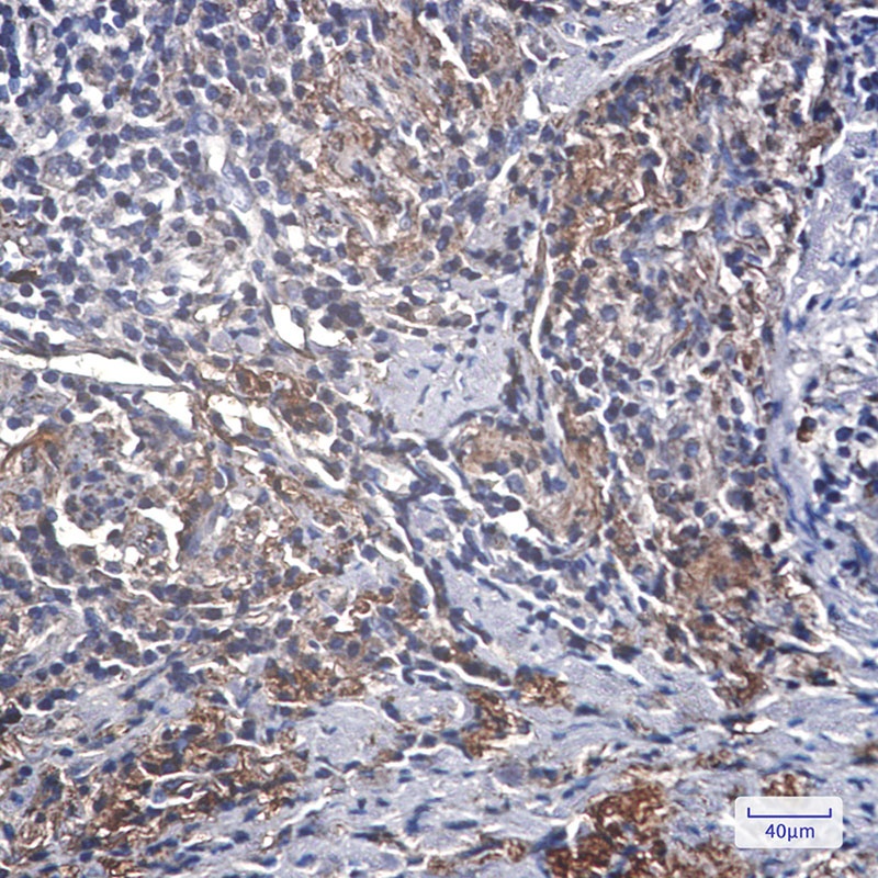 [KD] IGFBP7 Rabbit mAb