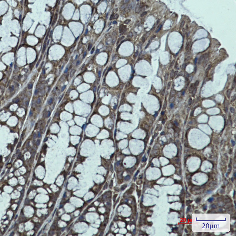 IGF2BP1 Antibody