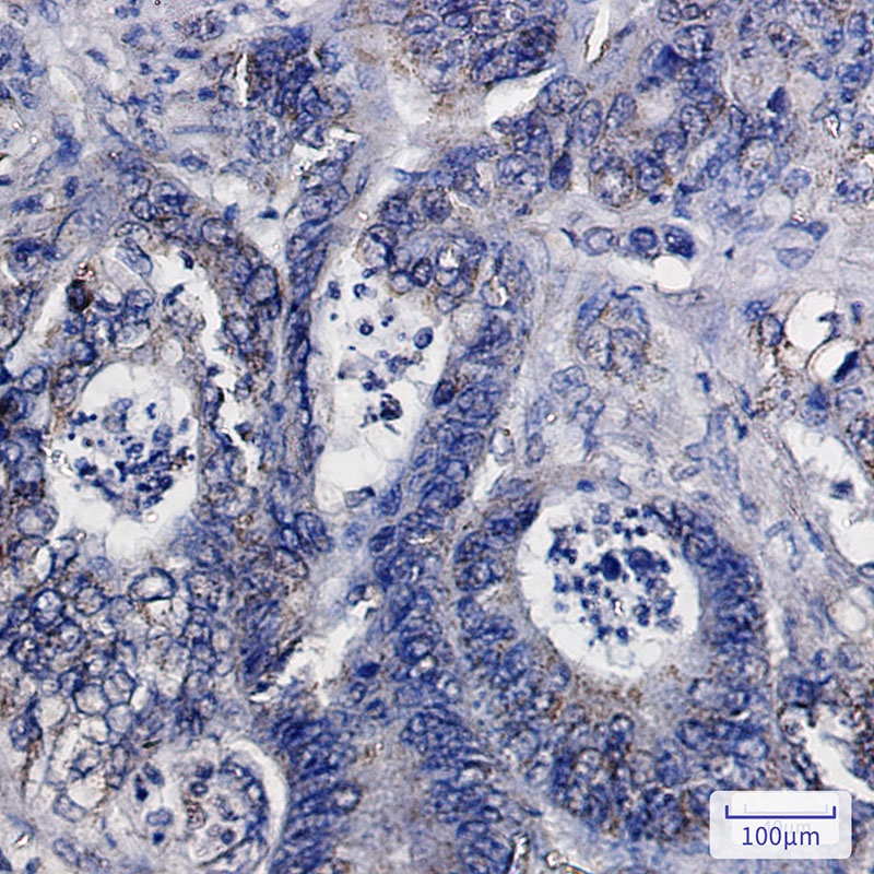 IDH2 Rabbit mAb