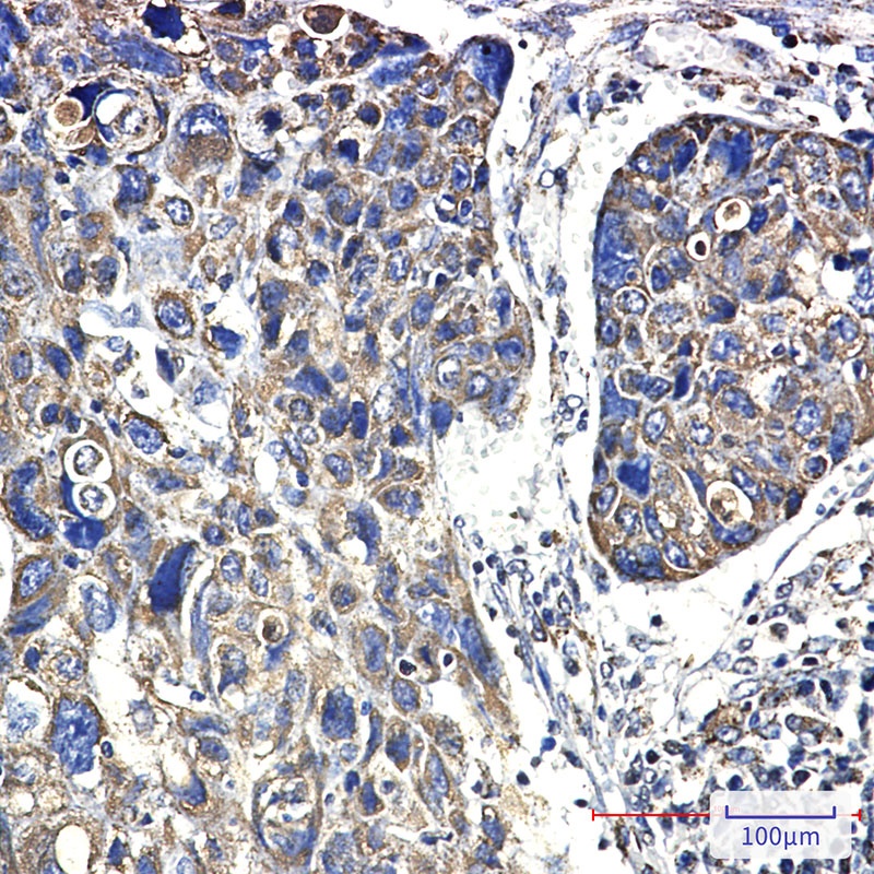 HSPD1 Antibody