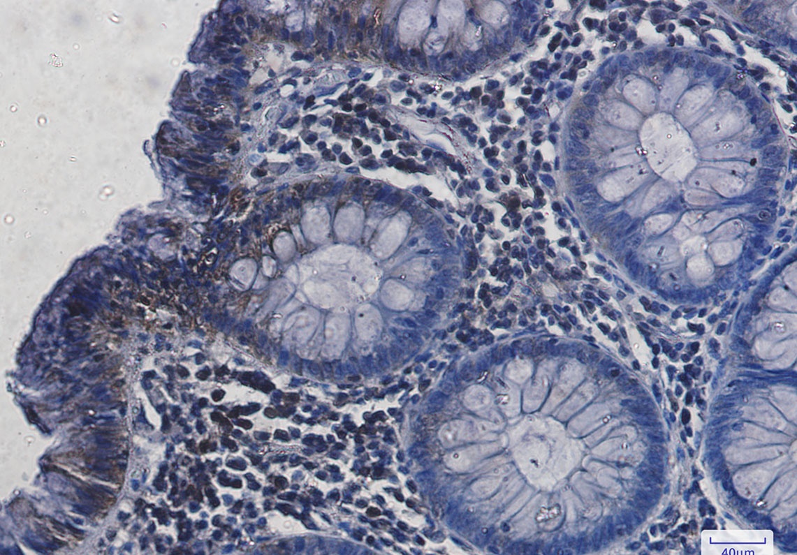 HSPA8 Antibody