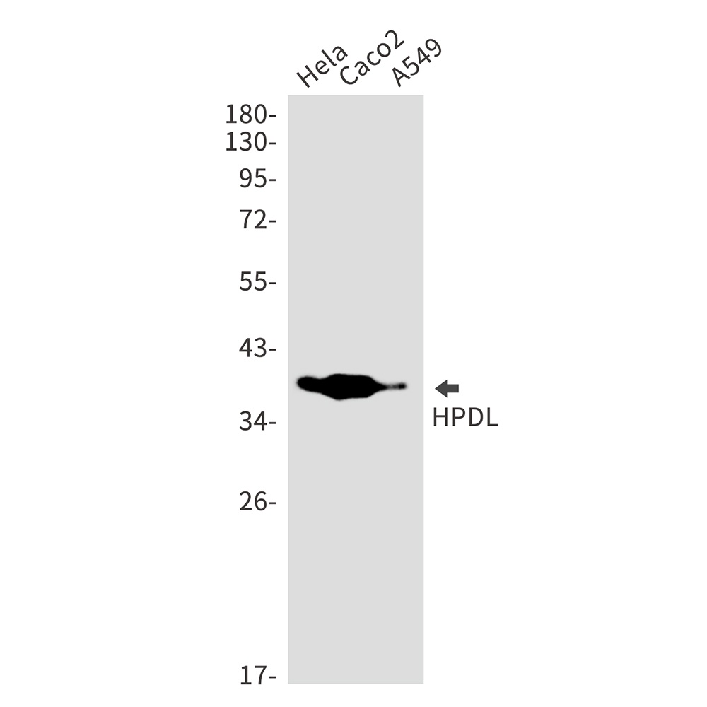 HPDL Rabbit Monoclonal Antibody