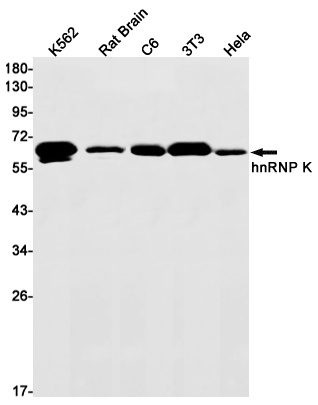 hnRNP K Rabbit mAb